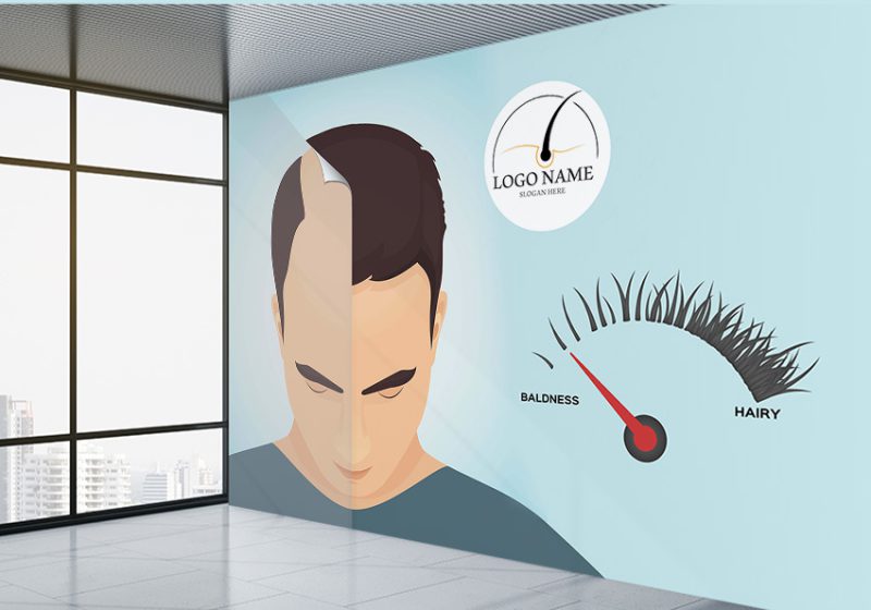 پوستر سه بعدی پزشکی زیبایی طرح کاشت مو