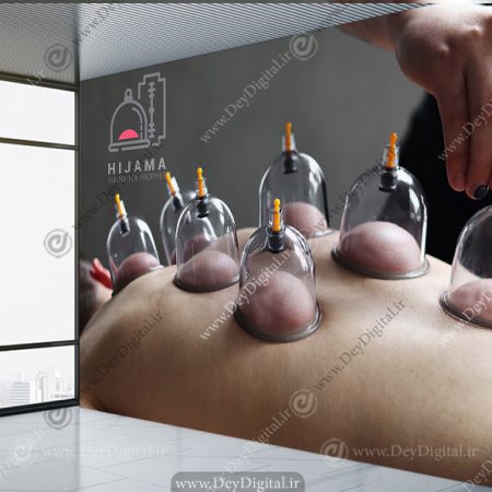 پوستر سه بعدی بادکش درمانی