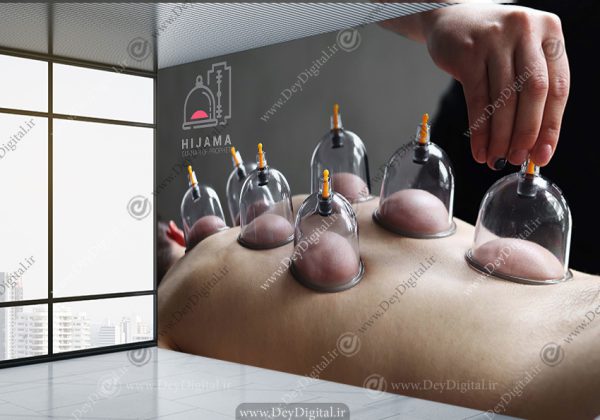 پوستر سه بعدی بادکش درمانی