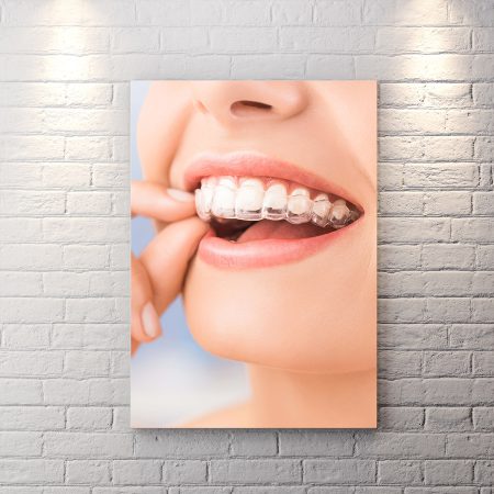 تابلو شاسی دکوراتیو دندان پزشکی طرح لبخند زیبا