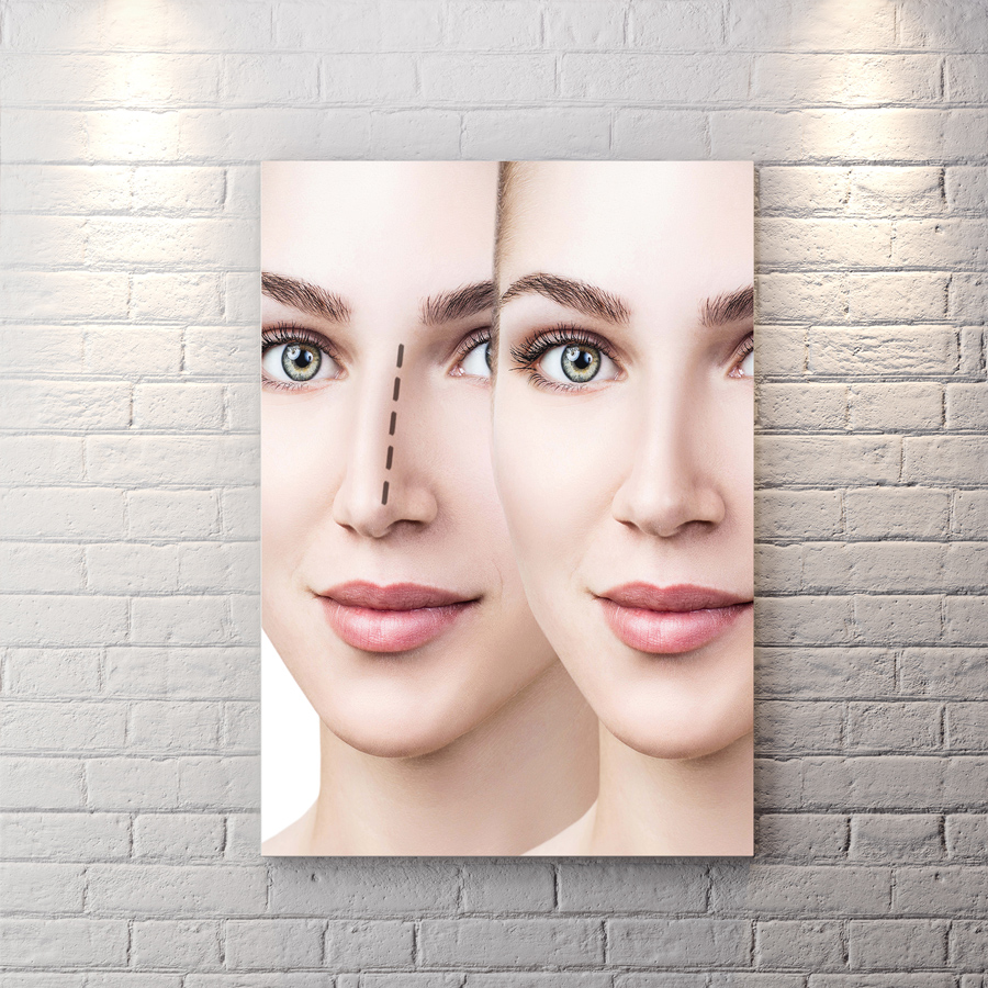 تابلو شاسی برای مطب دکتر جراح بینی