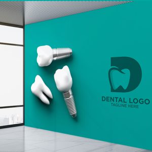 پوستر دیواری طرح دندان ایمپلنت برای دندانپزشکی