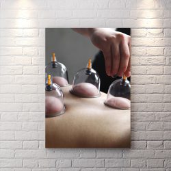 تابلو شاسی برای مرکز طب سنتی و بادکش