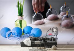 پوستر کاغذ دیواری مرکز بادکش درمانی و حجامت پوستر سه بعدی بادکش درمانی
