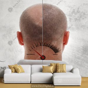 پوستر دیواری کاشت مو